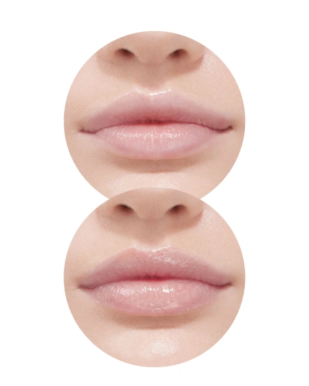 Influence Balsam-stick Glow Injection Hydrogenesis, 2 g